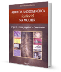 Capa do livro - Alopecia Androgenética (Calvície) na Mulher